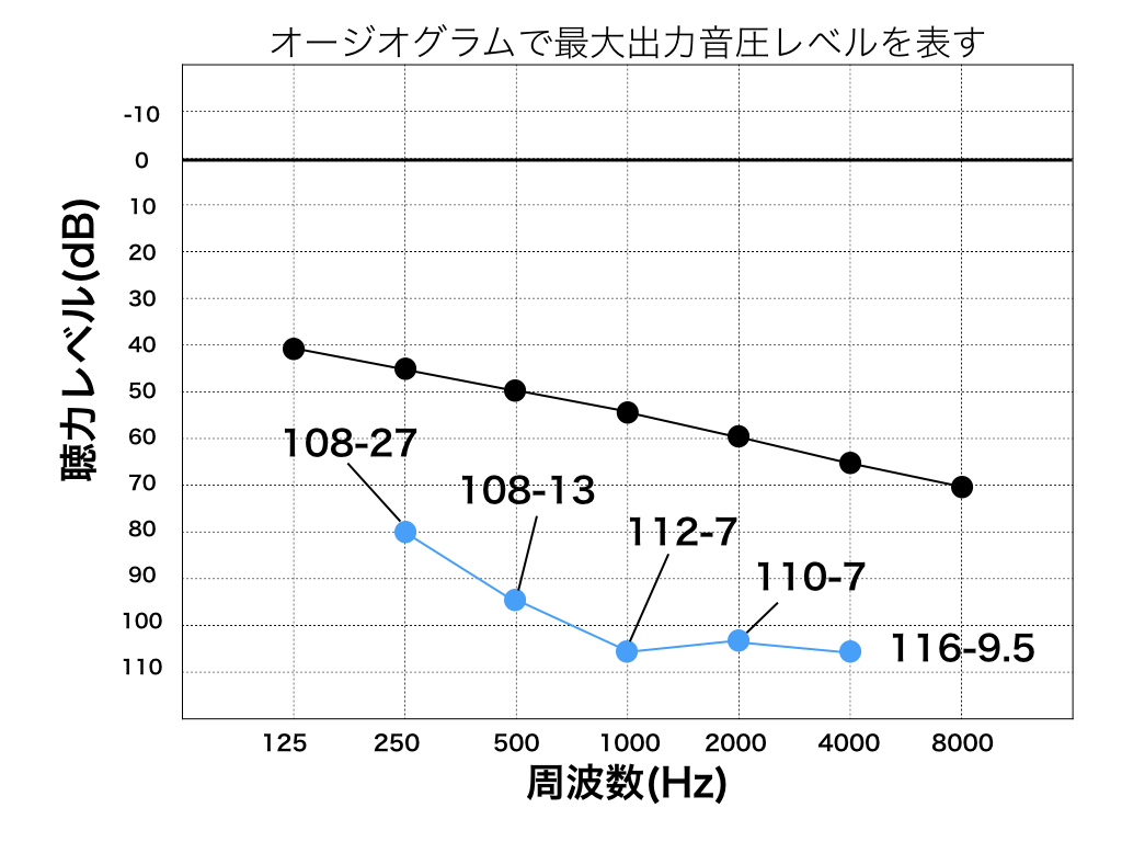 オージオグラムのコピー5.005.jpeg