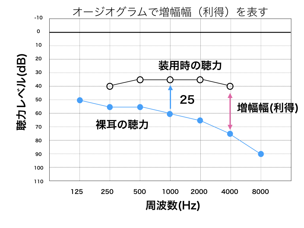 オージオグラムのコピー5.007.jpeg